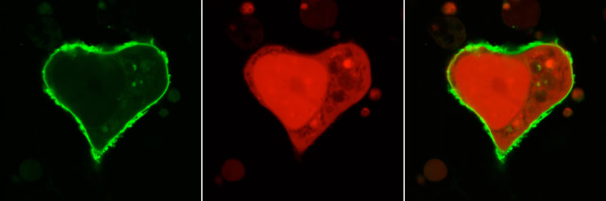 “Hearts”, imagen propiedad de Phil Sanders del grupo de Ingenieria de Red Génica del Centro de Regulación Genómica (CRG), galardonada con el primer premio del Concurso Foto El.lipse